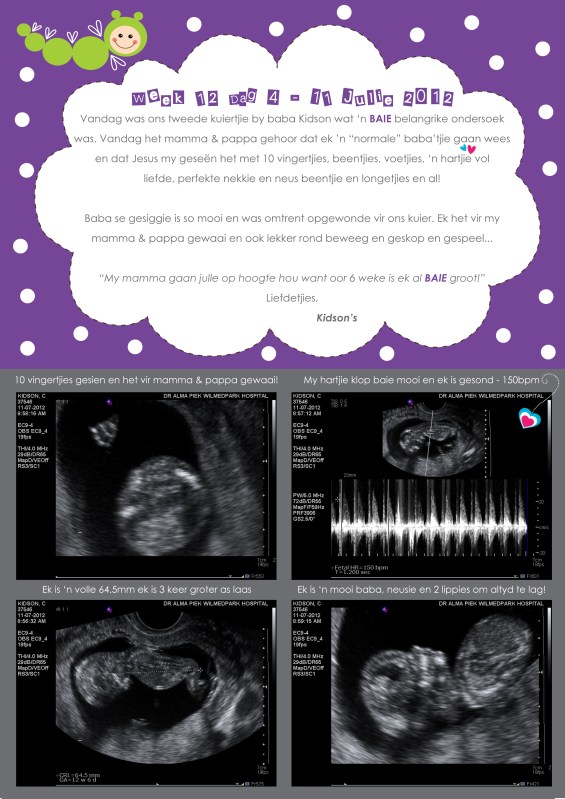 Baba Kidson 12 Weke